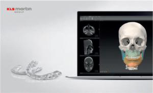 IPS individual patient solutions - kls martin