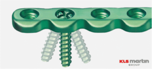 locking screw-kls martin